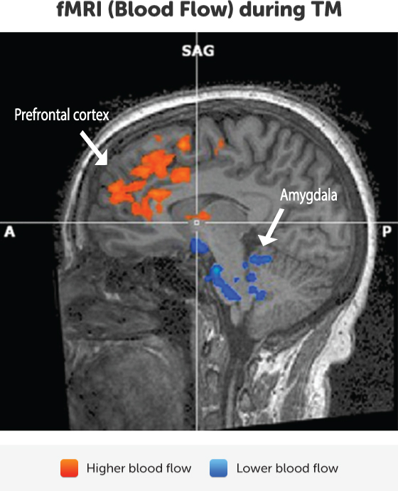 bloodflow-prefrontal-amygdala
